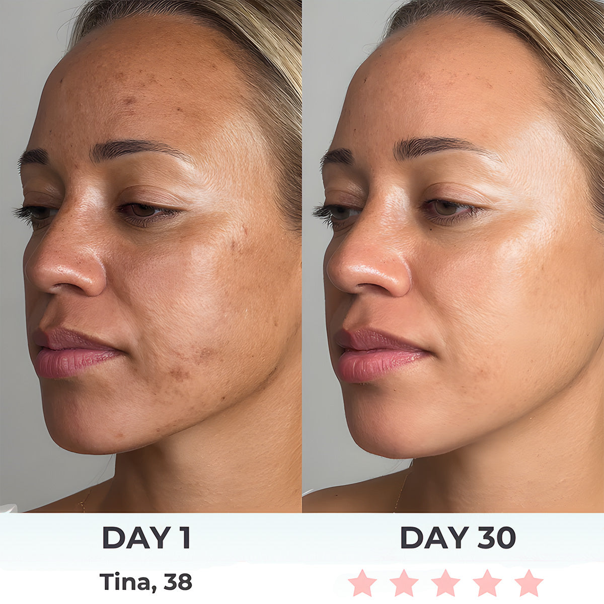 7LED Color Vibrating Neck Device Beauty Gift, neck and face skin massager, 1 piece set portable usb charging, electric Facial ma