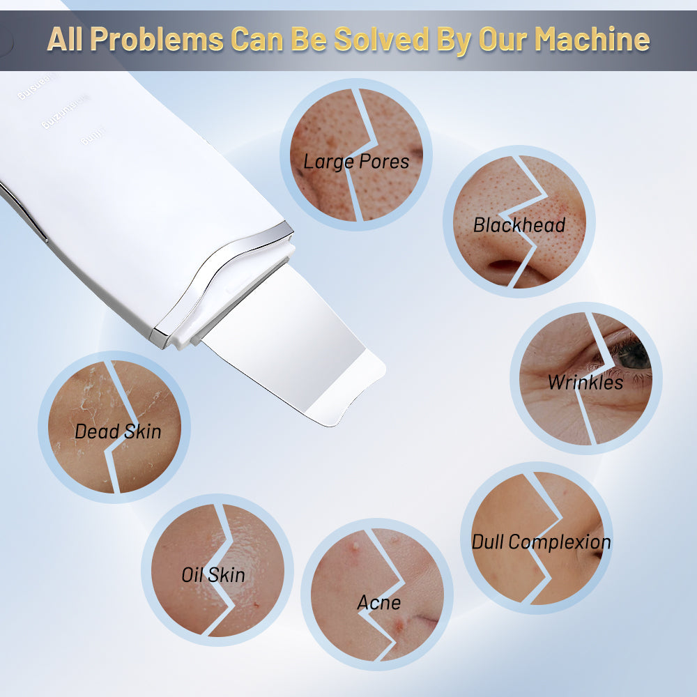Ultrasonic Skin Scrubber Ance Pore Cleaner Peeling Blackhead Remover Deep Face Cleaning Ultrasonic Ion Facial Shovel Cleanser
